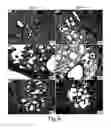 Fig. 06 - Method of treating viral infections with ultraviolet light