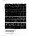 Fig. 07 - METHODS FOR THE TREATMENT OF DISEASES ASSOCIATED WITH THE SECRETION OF HMGB1