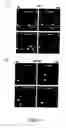 Fig. 06 - Compositions and methods to control angiogenesis with cupredoxins