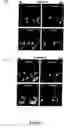Fig. 07 - Compositions and methods to control angiogenesis with cupredoxins