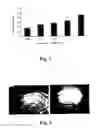 Fig. 02 - METHODS FOR TREATING DEPRESSION, NEURODEGENERATION, INHIBITING AMYLOID BETA DEPOSITION, DELAYING SENESCENCE, AND EXTENDING LIFE SPANS WITH HETEROCYCLIC COMPOUNDS
