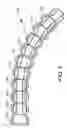 Fig. 06 - Implantable malleable penile prosthetic device