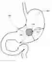 Fig. 01 - Autofluorescent imaging and target ablation