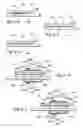 Fig. 09 - Methods and apparatus for treating disorders of the ear nose and throat