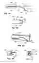Fig. 03 - Vessel retractor