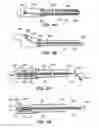 Fig. 04 - Vessel retractor