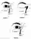 Fig. 04 - Microelectronic biosensor plug