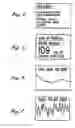 Fig. 05 - System for performing diabetes self-care