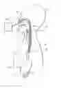 Fig. 01 - Device for assessing perfusion failure in a patient by measurement of blood flow