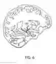 Fig. 07 - Selective MR imaging of segmented anatomy