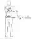 Fig. 01 - Method and apparatus for locating the fossa ovalis and performing transseptal puncture