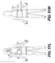 Fig. 49 - Obstructive sleep apnea treatment devices, systems and methods