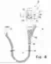Fig. 05 - Biopsy collection device