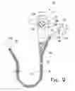 Fig. 06 - Biopsy collection device