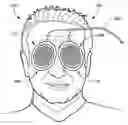 Fig. 01 - Method of preventing nerve damage positional injury during surgery