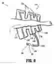 Fig. 06 - Garment Detection Method and System for Delivering Compression Treatment