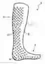Fig. 01 - Orthosis and method for manufacture thereof