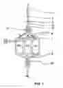 Fig. 02 - Apheresis Tubing Set