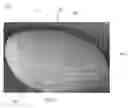 Fig. 10 - Microprotrusion Arrays and Methods for Using Same to Deliver Substances into Tissue