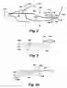 Fig. 03 - Method and Apparatus for Detecting Air Bubbles