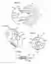 Fig. 12 - Subcutaneous infusion device and method including tapered cannula