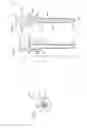 Fig. 17 - Subcutaneous infusion device and method including tapered cannula
