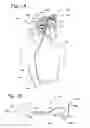 Fig. 02 - Infusion catheter