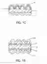 Fig. 03 - Method for making an appliance for delivering a composition, the appliance having an elastic layer and a shielding layer