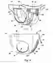 Fig. 04 - Method for using a disposable absorbent article as training pant