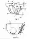 Fig. 08 - Method for using a disposable absorbent article as training pant