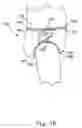 Fig. 13 - Disposable absorbent articles with zones comprising elastomeric components