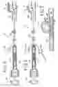 Fig. 04 - Method of delivering embolic particles to an aneurysm