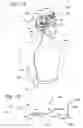 Fig. 02 - Infusion catheter with composite tip