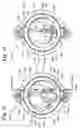 Fig. 21 - Infusion catheter with composite tip