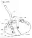 Fig. 30 - Infusion catheter with composite tip