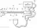 Fig. 01 - BIPOLAR ABLATION PROBE HAVING POROUS ELECTRODES FOR DELIVERING ELECTRICALLY CONDUCTIVE FLUID