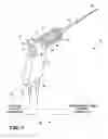 Fig. 02 - Neurostimulation delivery during transurethral prostate treatment