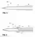Fig. 05 - Neurostimulation delivery during transurethral prostate treatment