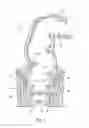 Fig. 02 - Systems and methods for treating dysfunctions in the intestines and rectum that adapt to the anatomic form and structure of different individuals