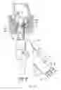 Fig. 11 - Systems and methods for treating dysfunctions in the intestines and rectum that adapt to the anatomic form and structure of different individuals
