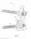 Fig. 04 - Angled washer polyaxial connection for dynamic spine prosthesis