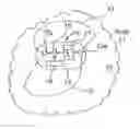 Fig. 01 - Methods and apparatus for manually suspending intrathoracic impedance fluid status measurements