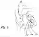 Fig. 04 - Electronic and biological pacemaker systems