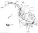 Fig. 06 - Electronic and biological pacemaker systems