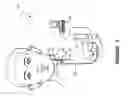 Fig. 02 - Patient management system for treating epilepsy using an implantable medical device