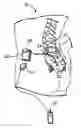 Fig. 01 - Controller for obtaining prescriptive analysis of functionality of implantable medical device leads, system and method therefore