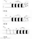 Fig. 06 - Implantable medical lead with threaded fixation