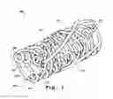 Fig. 02 - Temporal Intraluminal Stent, Methods of Making and Using