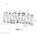 Fig. 04 - Temporal Intraluminal Stent, Methods of Making and Using
