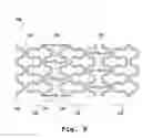 Fig. 09 - Temporal Intraluminal Stent, Methods of Making and Using